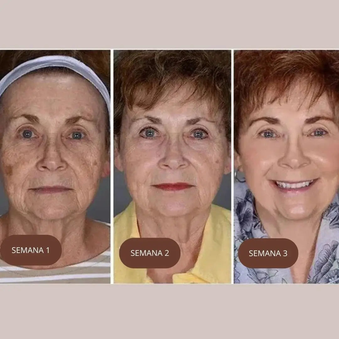 KIT NIACINAMIDA + RETINOL + ACIDO HIALURONICO THE ORDINARY