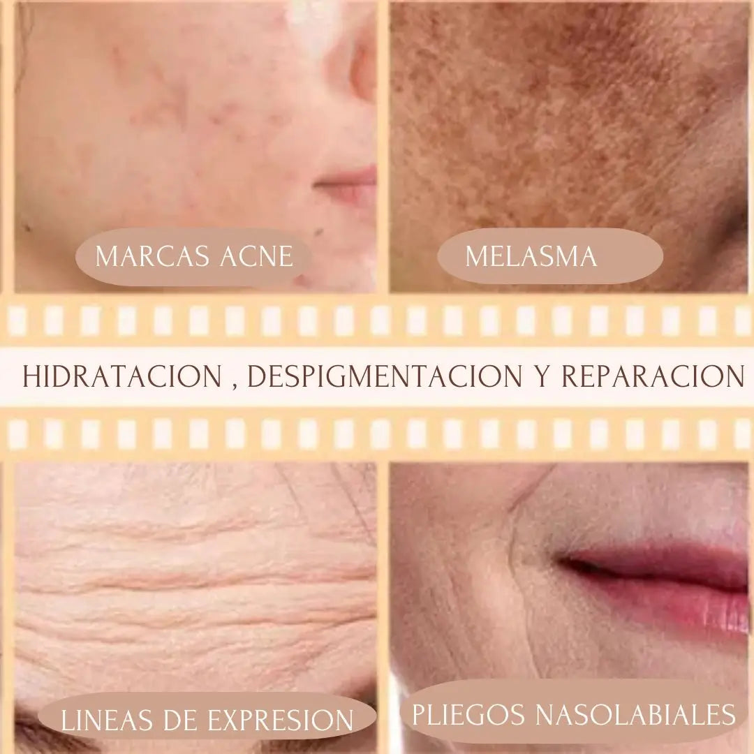KIT NIACINAMIDA + RETINOL + ACIDO HIALURONICO THE ORDINARY