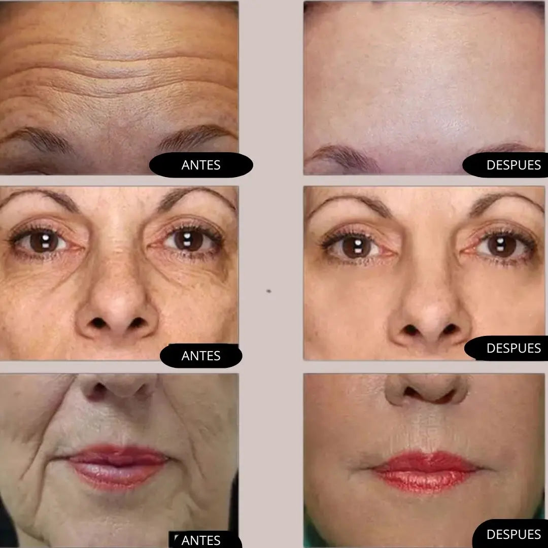 KIT NIACINAMIDA + RETINOL + ACIDO HIALURONICO THE ORDINARY