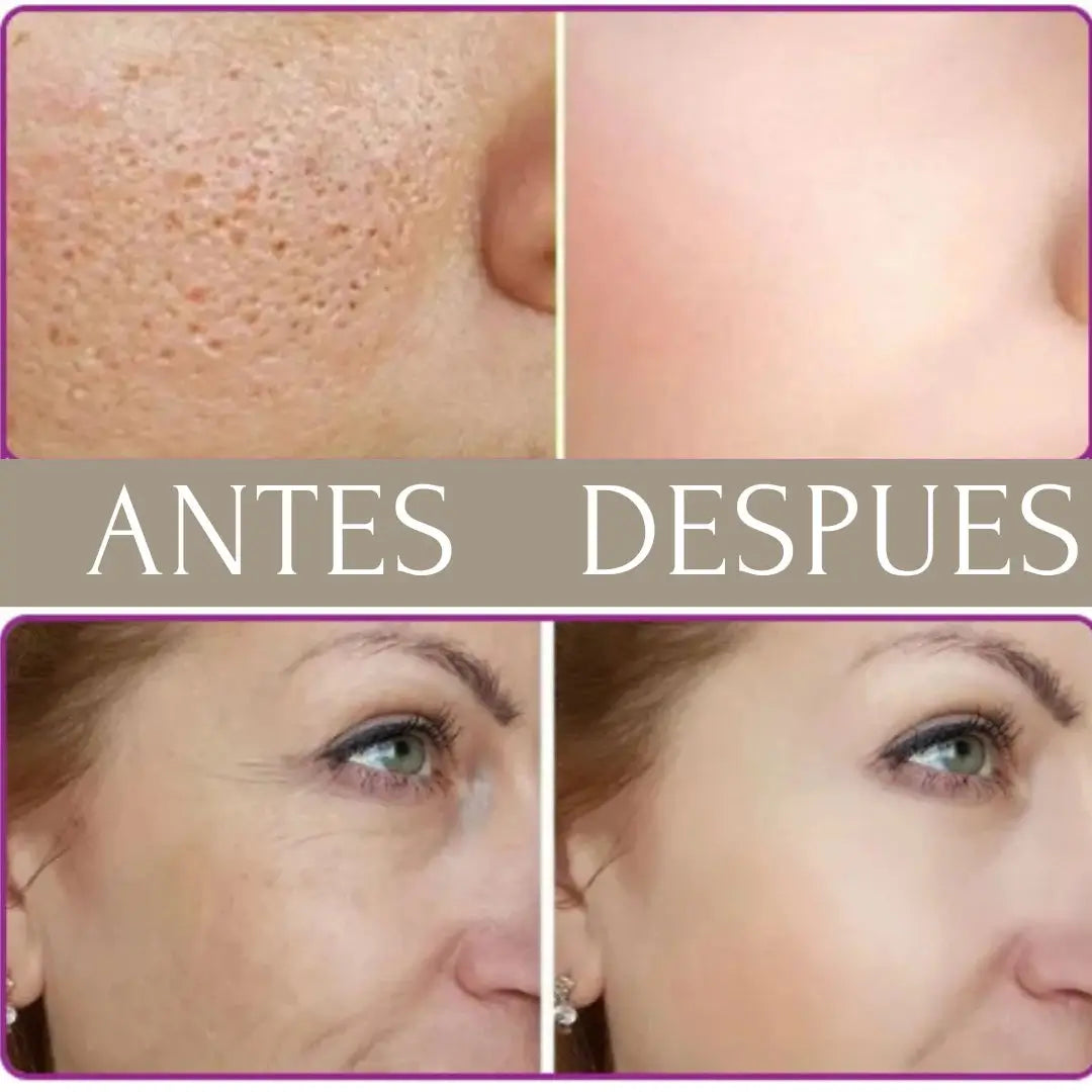 KIT NIACINAMIDA + RETINOL + ACIDO HIALURONICO THE ORDINARY