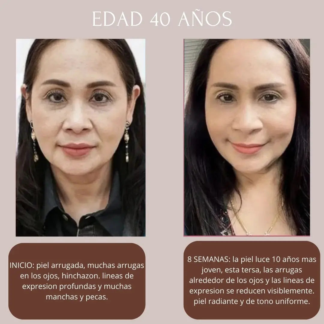 KIT NIACINAMIDA + RETINOL + ACIDO HIALURONICO THE ORDINARY