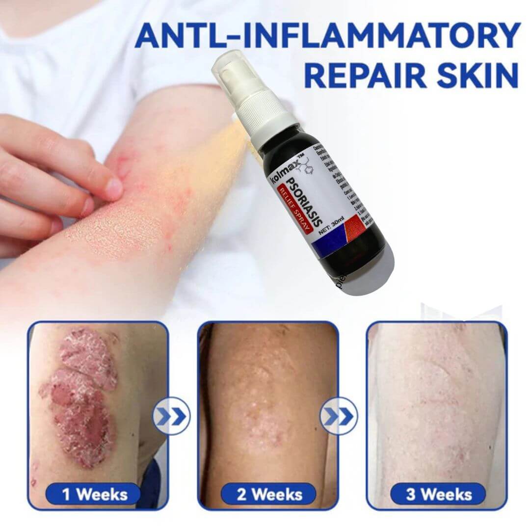 KOLMAX Spray Alivio Psoriasis SUPER OFERTA 2 X 70900