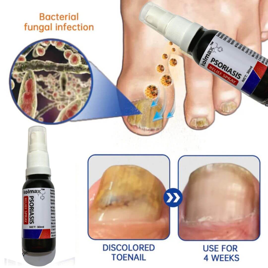 KOLMAX Spray Alivio Psoriasis SUPER OFERTA 2 X 70900