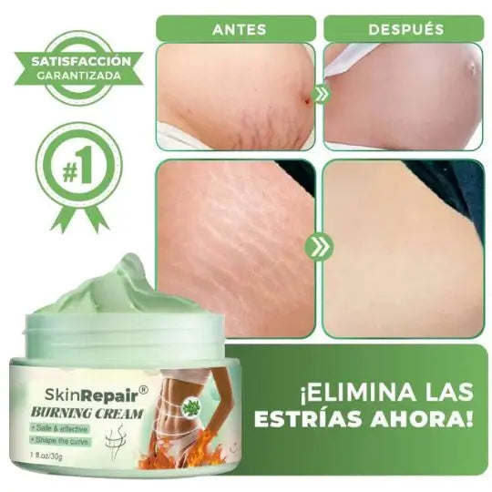 DERMARENEW Crema antiestrias de SkinCare