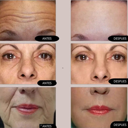 KIT NIACINAMIDA + RETINOL + ACIDO HIALURONICO THE ORDINARY