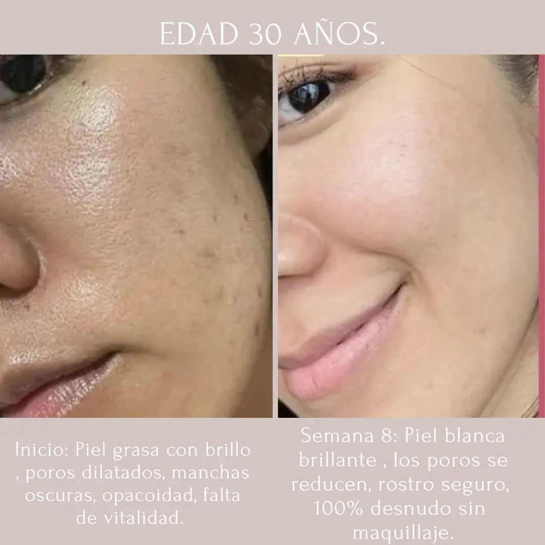 KIT NIACINAMIDA + RETINOL + ACIDO HIALURONICO THE ORDINARY