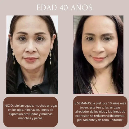 KIT NIACINAMIDA + RETINOL + ACIDO HIALURONICO THE ORDINARY